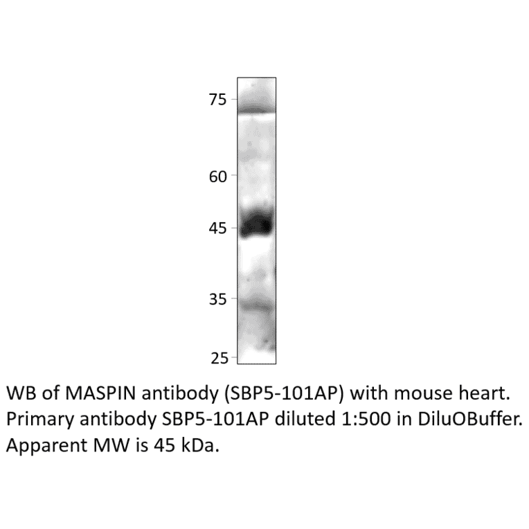Anti-MASPIN Antibody from FabGennix (SPB5-101AP) - Antibodies.com