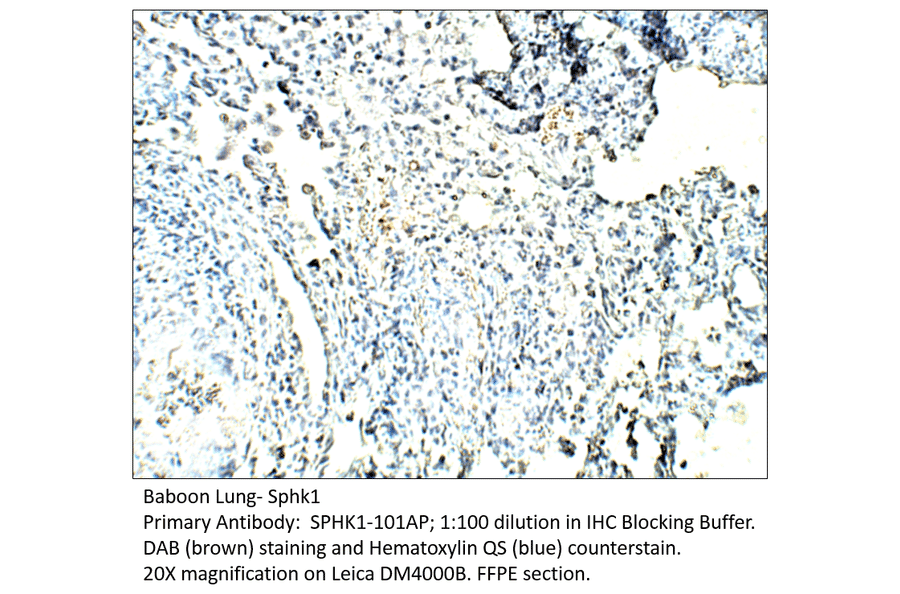 Anti-SPHK1 Antibody from FabGennix (SPHK1-101AP) - Antibodies.com