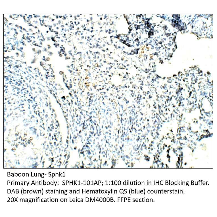 Anti-SPHK1 Antibody from FabGennix (SPHK1-101AP) - Antibodies.com