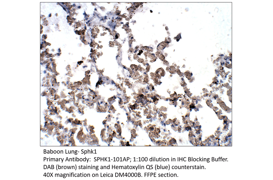 Anti-SPHK1 Antibody from FabGennix (SPHK1-101AP) - Antibodies.com