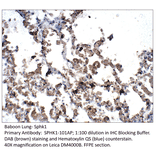 Anti-SPHK1 Antibody from FabGennix (SPHK1-101AP) - Antibodies.com