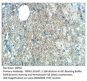 Anti-SRPX2 Antibody from FabGennix (SRPX2-201AP) - Antibodies.com