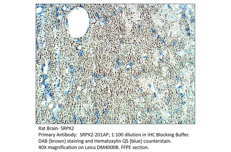 Anti-SRPX2 Antibody from FabGennix (SRPX2-201AP) - Antibodies.com