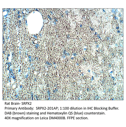 Anti-SRPX2 Antibody from FabGennix (SRPX2-201AP) - Antibodies.com