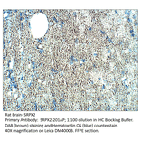 Anti-SRPX2 Antibody from FabGennix (SRPX2-201AP) - Antibodies.com