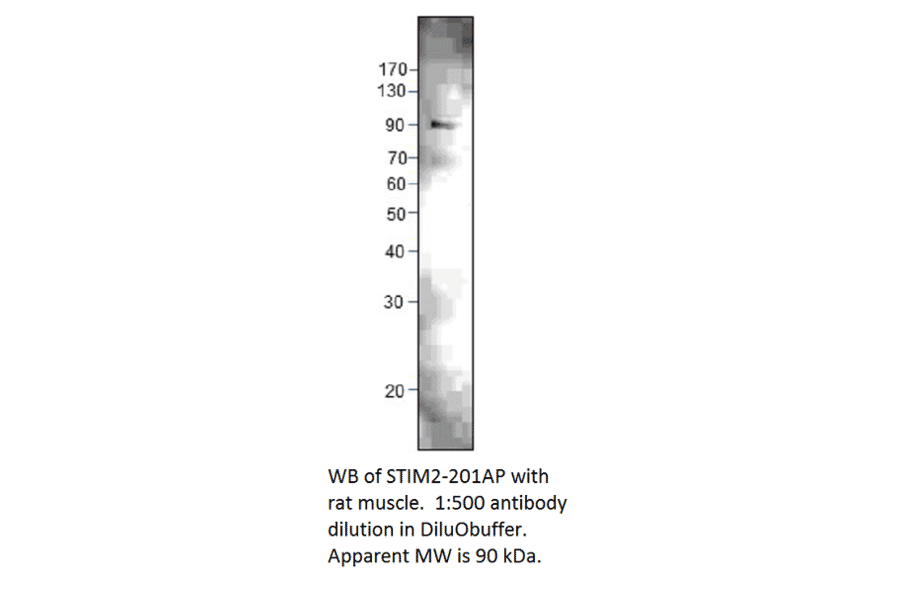 Anti-STIM2 Antibody from FabGennix (STIM2-201AP) - Antibodies.com