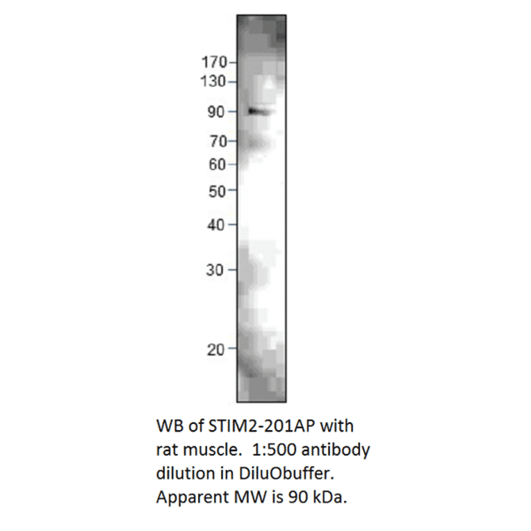 Anti-STIM2 Antibody from FabGennix (STIM2-201AP) - Antibodies.com