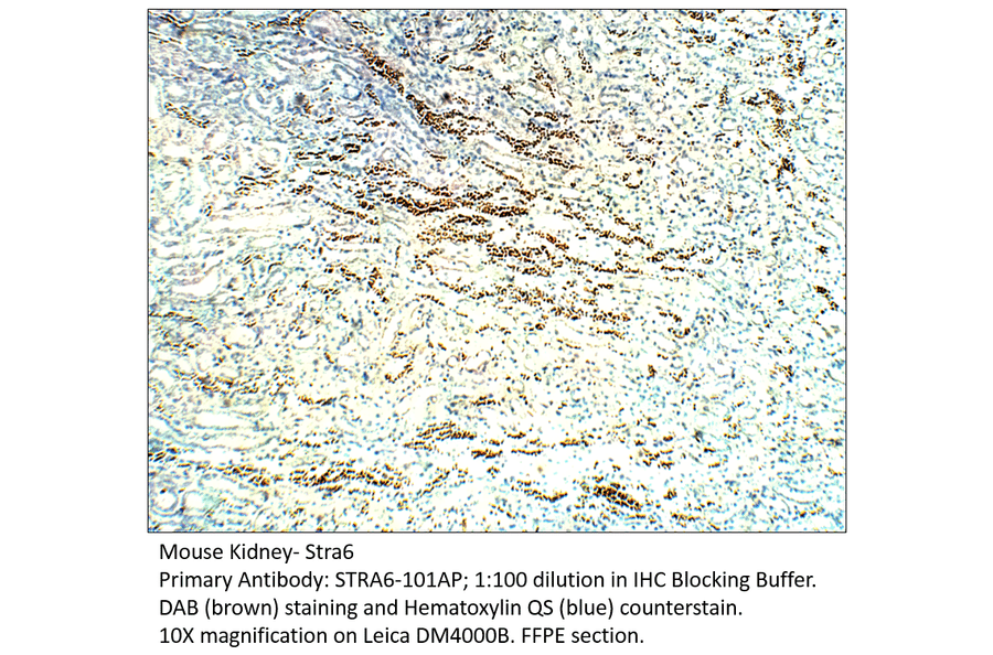 Anti-Stra6 Antibody from FabGennix (STRA6-101AP) - Antibodies.com