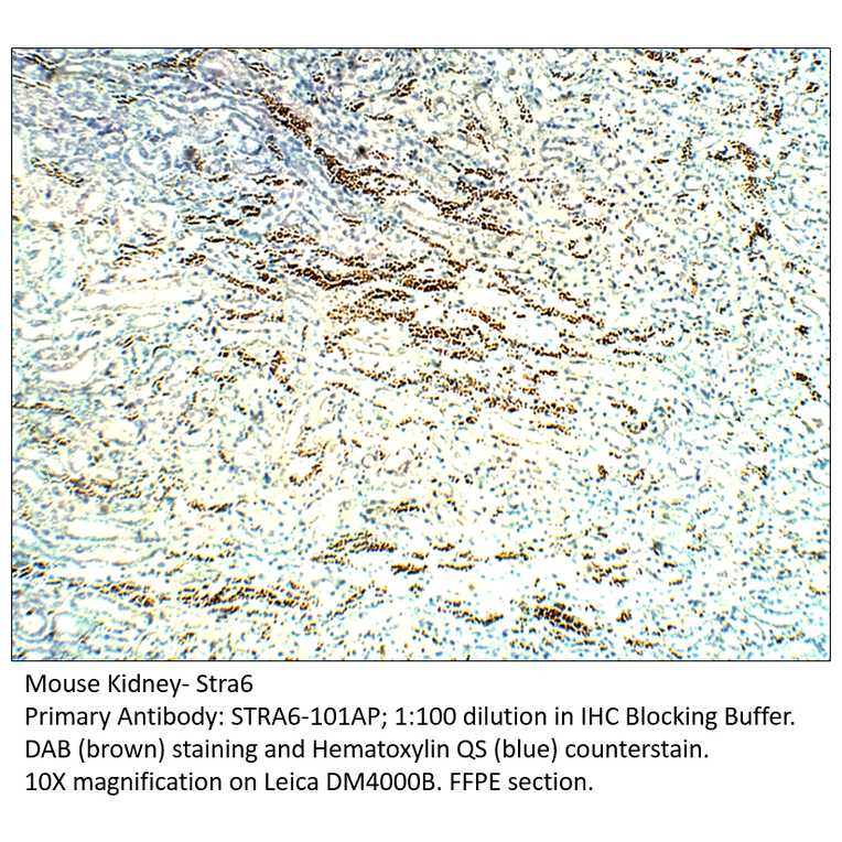 Anti-Stra6 Antibody from FabGennix (STRA6-101AP) - Antibodies.com