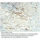 Anti-Stra6 Antibody from FabGennix (STRA6-101AP) - Antibodies.com