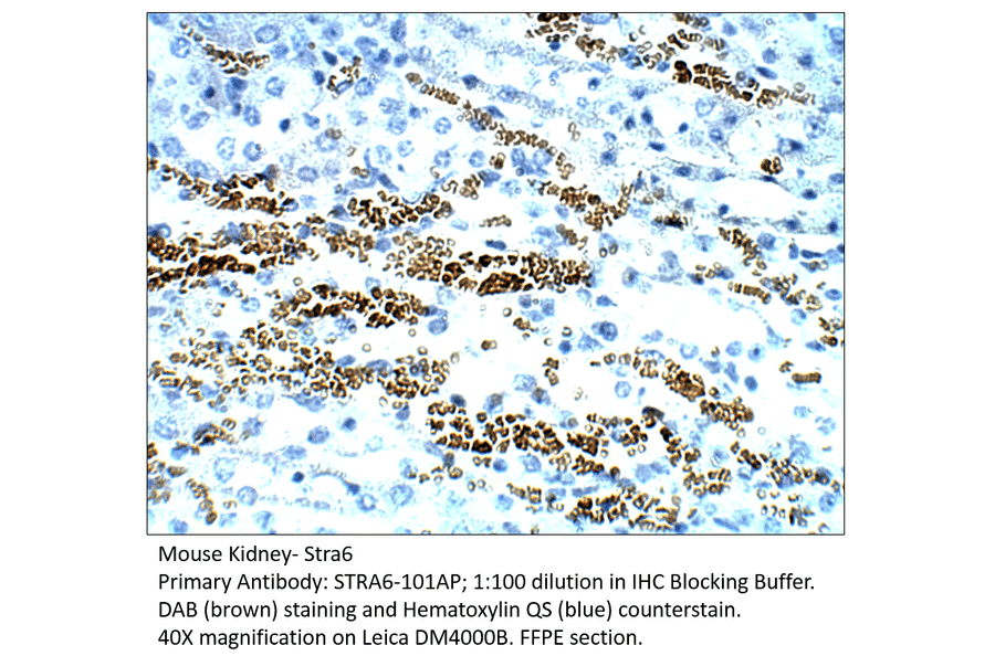 Anti-Stra6 Antibody from FabGennix (STRA6-101AP) - Antibodies.com