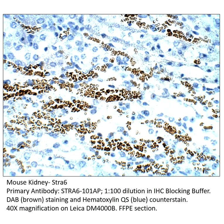 Anti-Stra6 Antibody from FabGennix (STRA6-101AP) - Antibodies.com