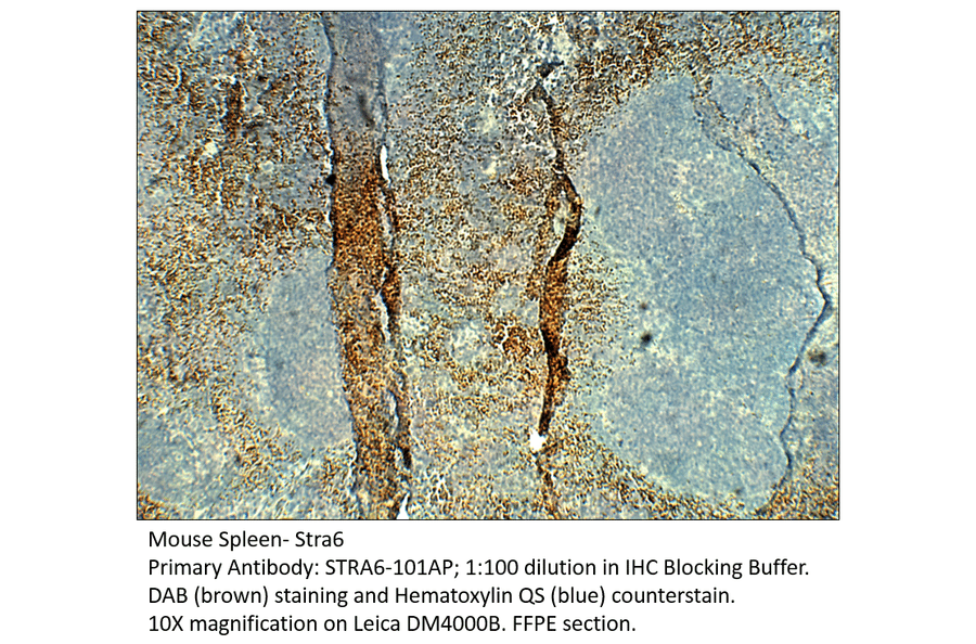 Anti-Stra6 Antibody from FabGennix (STRA6-101AP) - Antibodies.com