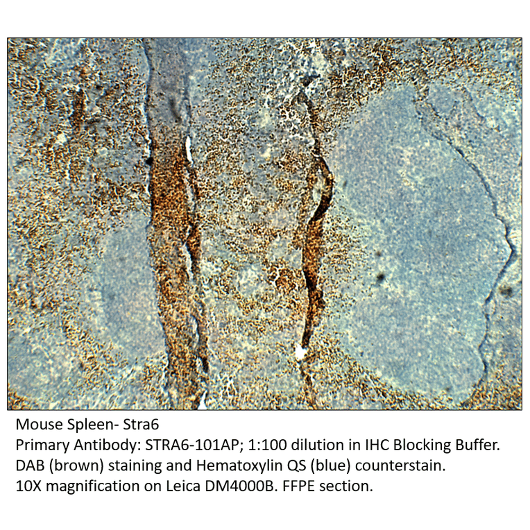 Anti-Stra6 Antibody from FabGennix (STRA6-101AP) - Antibodies.com