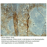 Anti-Stra6 Antibody from FabGennix (STRA6-101AP) - Antibodies.com