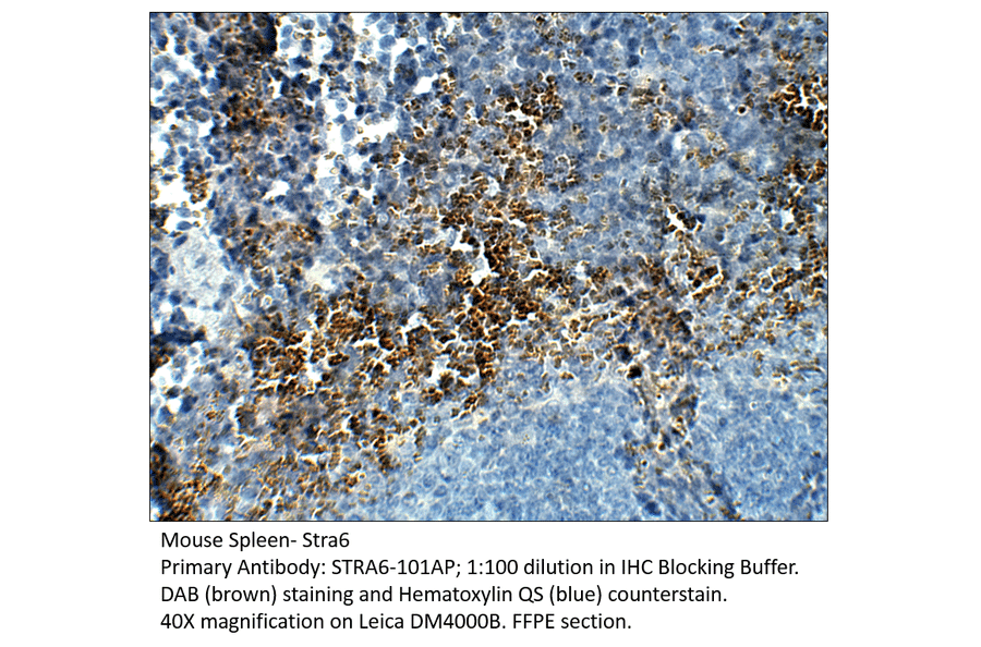 Anti-Stra6 Antibody from FabGennix (STRA6-101AP) - Antibodies.com