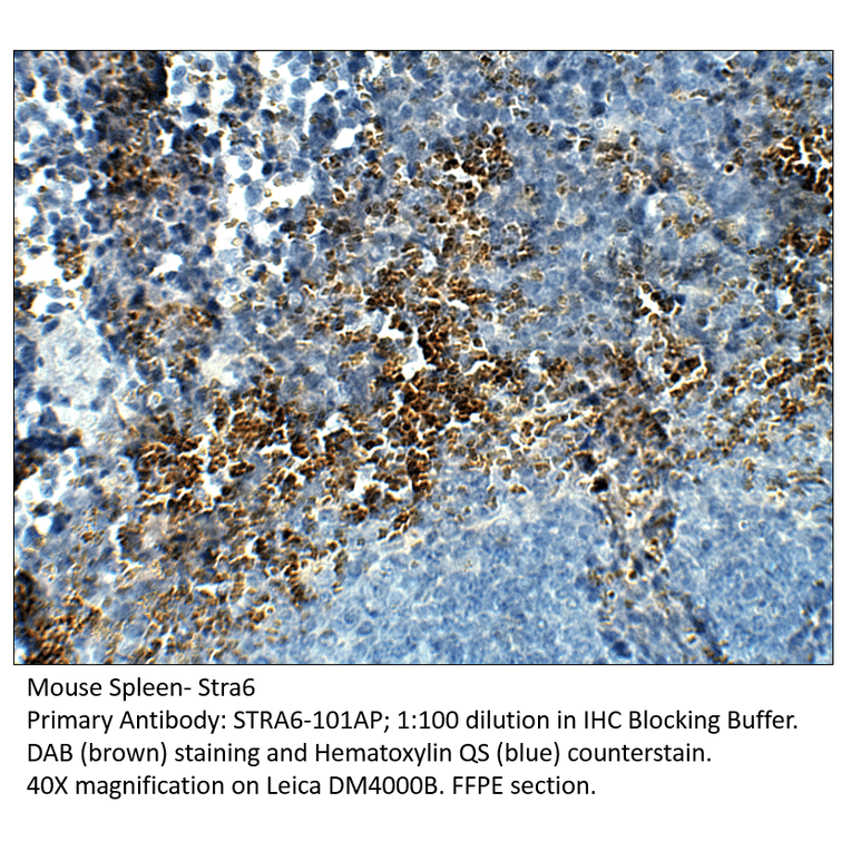 Anti-Stra6 Antibody from FabGennix (STRA6-101AP) - Antibodies.com