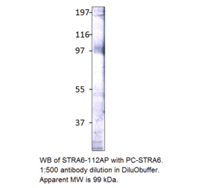 Anti-Stra6 Antibody from FabGennix (STRA6-112AP) - Antibodies.com
