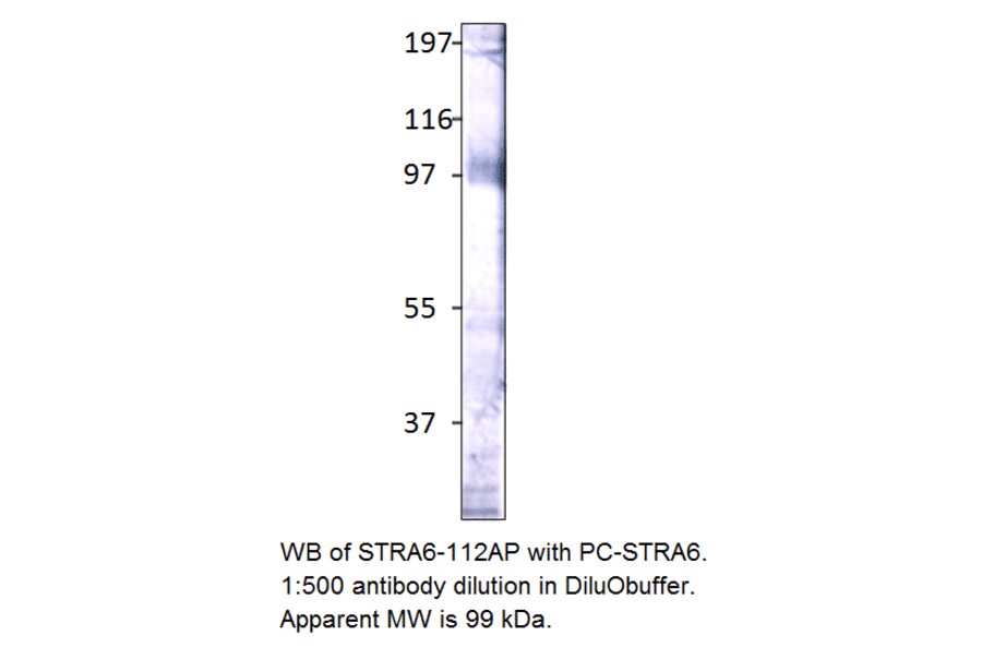 Anti-Stra6 Antibody from FabGennix (STRA6-112AP) - Antibodies.com