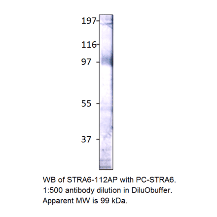 Anti-Stra6 Antibody from FabGennix (STRA6-112AP) - Antibodies.com