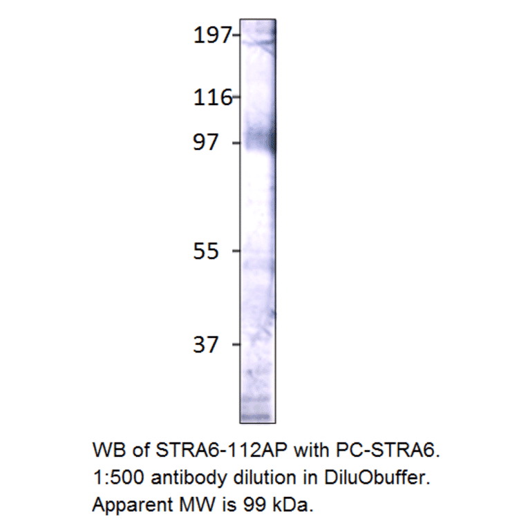 Anti-Stra6 Antibody from FabGennix (STRA6-112AP) - Antibodies.com