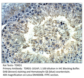 Anti-TDRD1 Antibody from FabGennix (TDRD1-101AP) - Antibodies.com