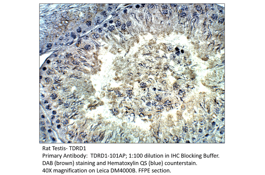 Anti-TDRD1 Antibody from FabGennix (TDRD1-101AP) - Antibodies.com