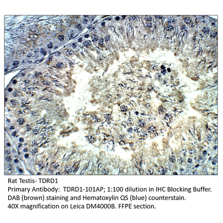 Anti-TDRD1 Antibody from FabGennix (TDRD1-101AP) - Antibodies.com