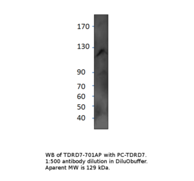 Anti-TDRD7 Antibody from FabGennix (TDRD7-701AP) - Antibodies.com