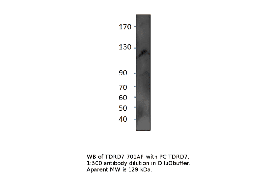 Anti-TDRD7 Antibody from FabGennix (TDRD7-701AP) - Antibodies.com