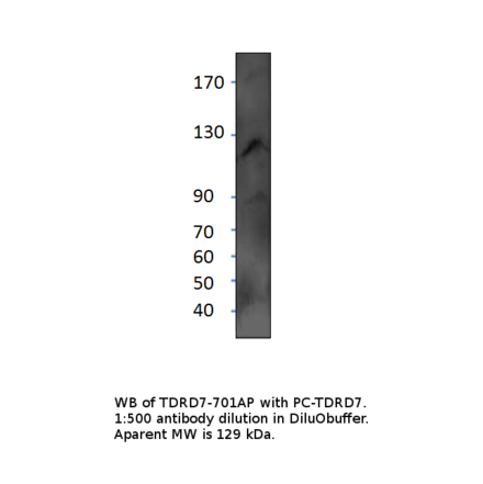 Anti-TDRD7 Antibody from FabGennix (TDRD7-701AP) - Antibodies.com