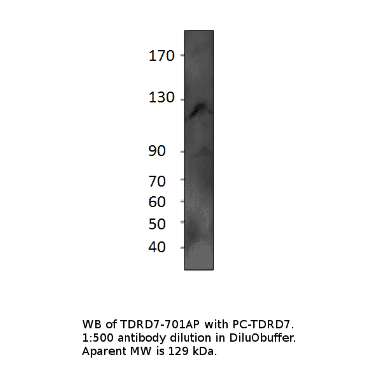 Anti-TDRD7 Antibody from FabGennix (TDRD7-701AP) - Antibodies.com