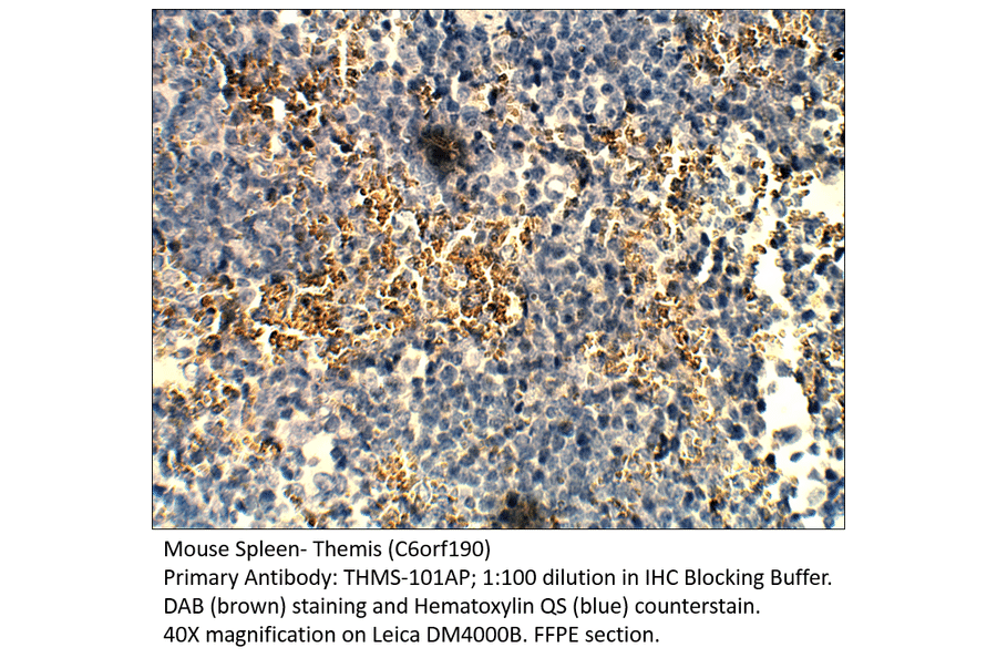 Anti-Themis Antibody from FabGennix (THMS-101AP) - Antibodies.com