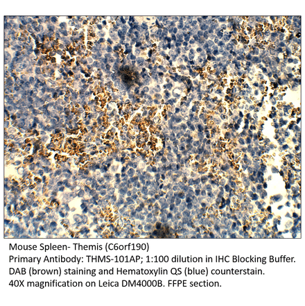 Anti-Themis Antibody from FabGennix (THMS-101AP) - Antibodies.com