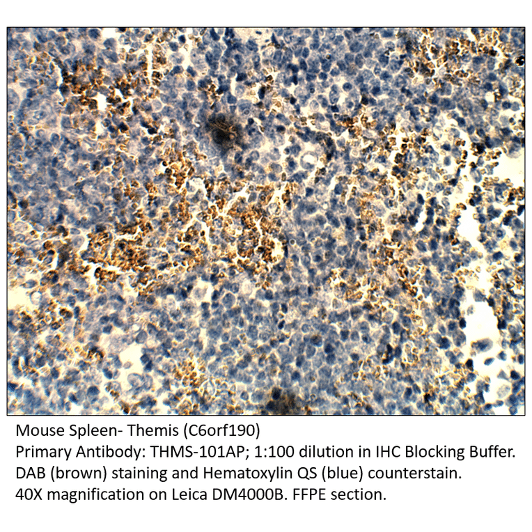 Anti-Themis Antibody from FabGennix (THMS-101AP) - Antibodies.com