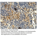 Anti-Themis Antibody from FabGennix (THMS-101AP) - Antibodies.com