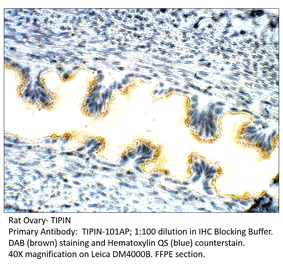 Anti-TIPIN Antibody (A54788) - Antibodies.com