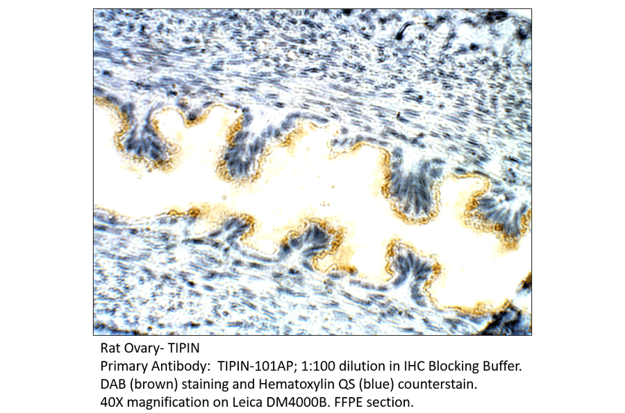 Anti-TIPIN Antibody from FabGennix (TIPIN-101AP) - Antibodies.com