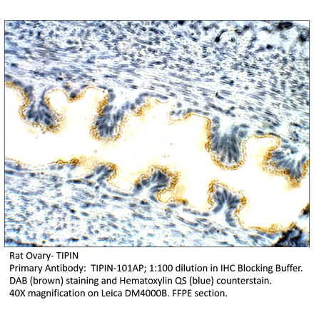 Anti-TIPIN Antibody from FabGennix (TIPIN-101AP) - Antibodies.com