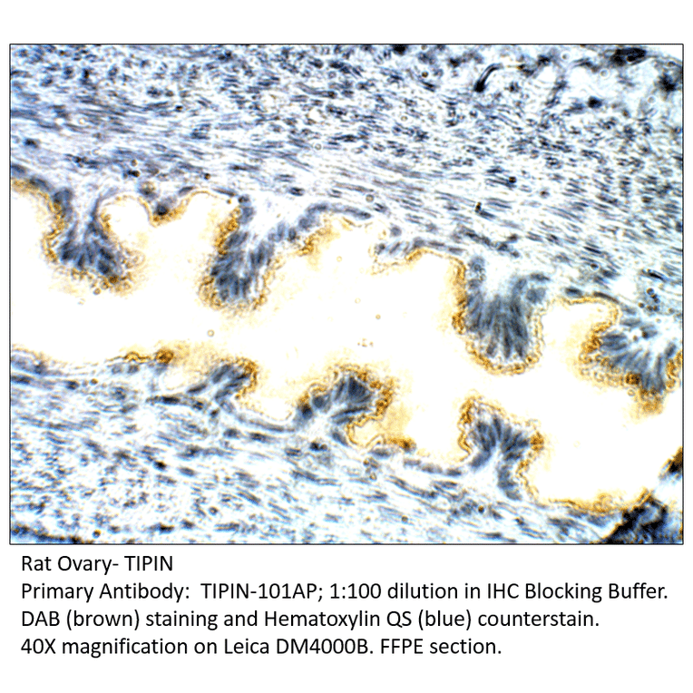 Anti-TIPIN Antibody from FabGennix (TIPIN-101AP) - Antibodies.com
