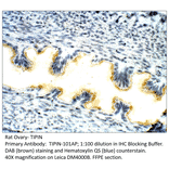 Anti-TIPIN Antibody from FabGennix (TIPIN-101AP) - Antibodies.com