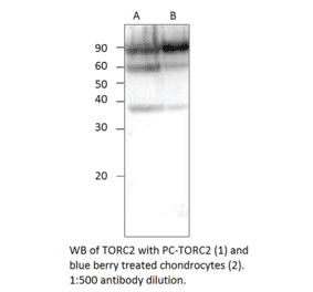 Anti-TORC2 Antibody from FabGennix (TORC2-101AP) - Antibodies.com