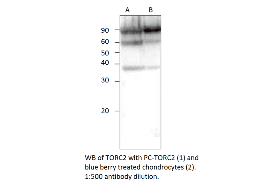 Anti-TORC2 Antibody from FabGennix (TORC2-101AP) - Antibodies.com