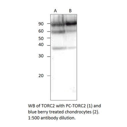Anti-TORC2 Antibody from FabGennix (TORC2-101AP) - Antibodies.com