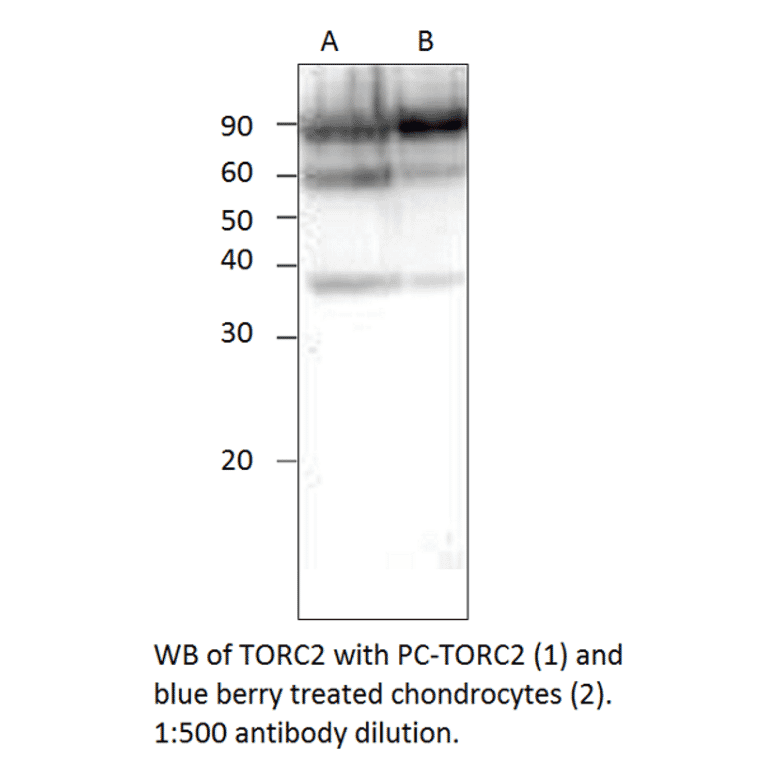 Anti-TORC2 Antibody from FabGennix (TORC2-101AP) - Antibodies.com