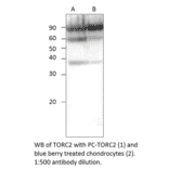 Anti-TORC2 Antibody from FabGennix (TORC2-101AP) - Antibodies.com