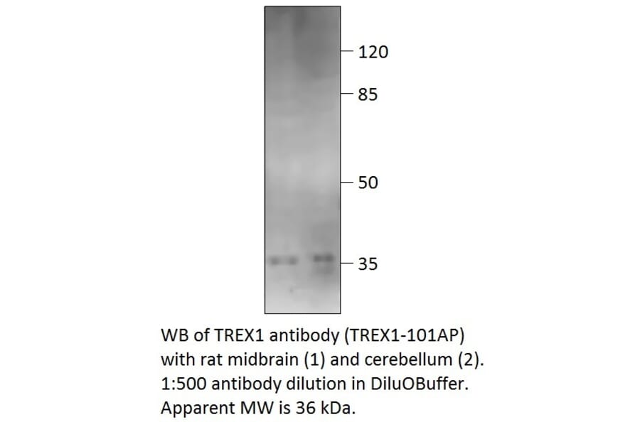 Anti-TREX1 Antibody from FabGennix (TREX1-101AP) - Antibodies.com
