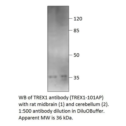 Anti-TREX1 Antibody from FabGennix (TREX1-101AP) - Antibodies.com