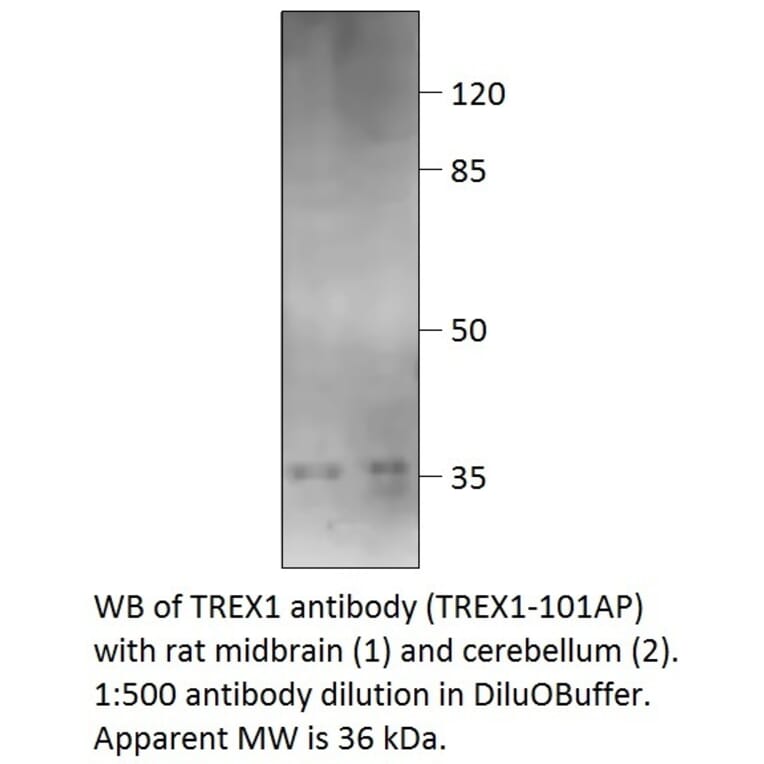 Anti-TREX1 Antibody from FabGennix (TREX1-101AP) - Antibodies.com