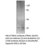 Anti-TREX1 Antibody from FabGennix (TREX1-101AP) - Antibodies.com